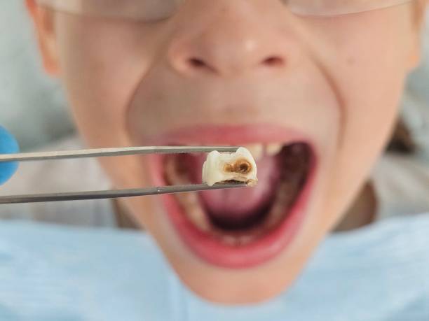 Best Pediatric Emergency Dentist in Bear Creek, AK